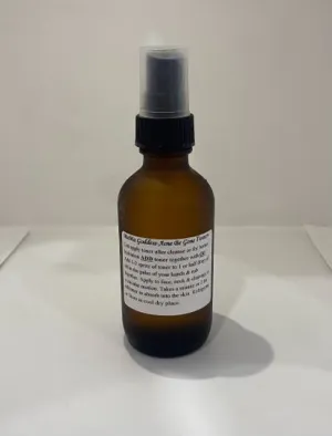 Acne Be Gone Hydrosol Toner